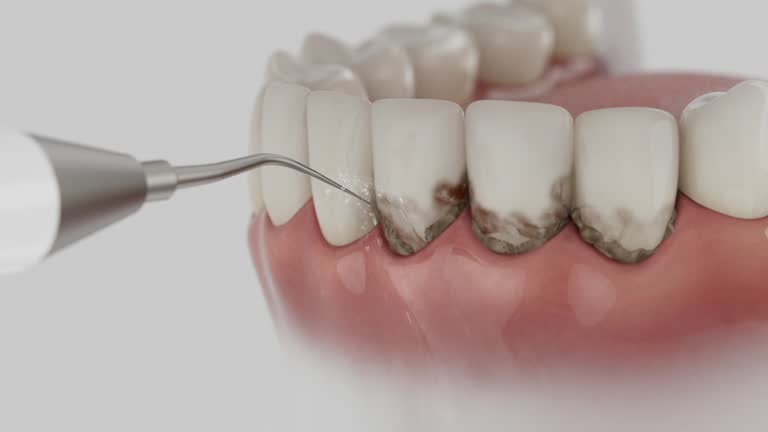 Reliable Tooth Extraction contractor in Hampton, VA by Smile Center Dentistry